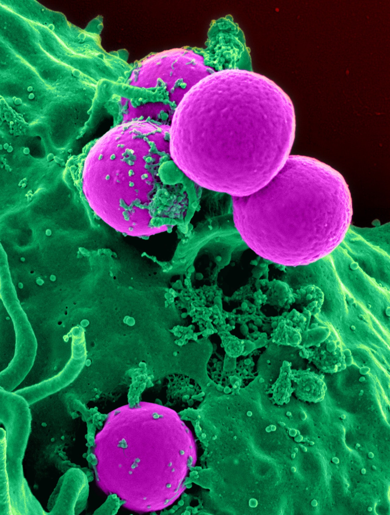 Modern Identification of Immunological Techniques