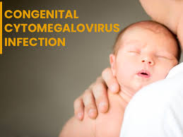 Congenital Cytomegalovirus Infection