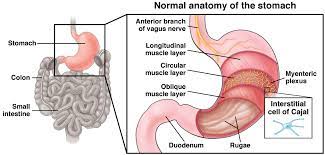 Manifestations of Gastroparesis